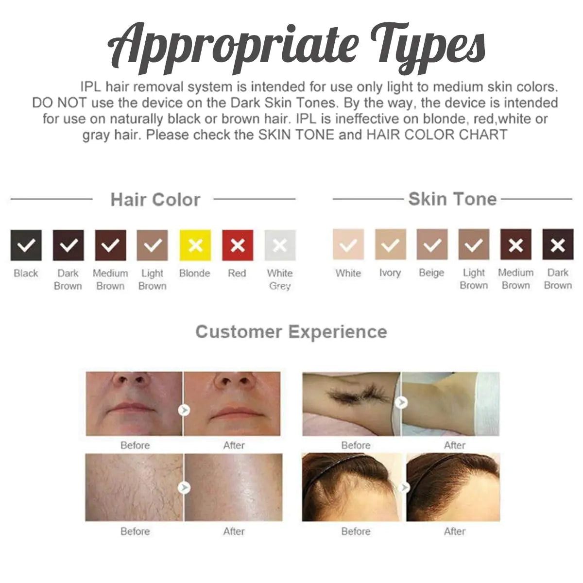 IPL Laser Hair Removal Device