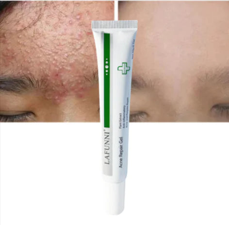 Acne Nourishing Repair Spot Gel